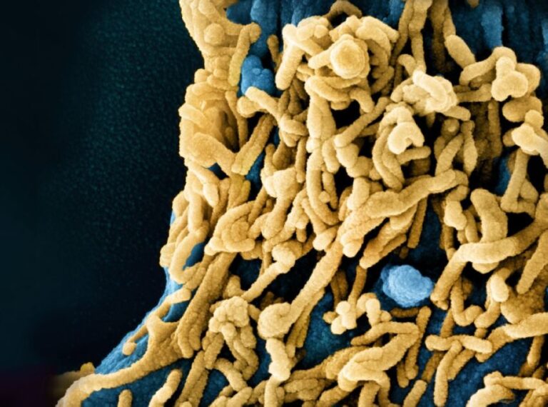 %d9%8a%d8%aa%d9%88%d9%81%d9%89 88 %d9%85%d9%86 %d8%a7%d9%84%d9%85%d8%b5%d8%a7%d8%a8%d9%8a%d9%86 %d9%83%d9%84 %d9%85%d8%a7 %d8%aa%d8%b1%d9%8a%d8%af %d9%85%d8%b9%d8%b1%d9%81%d8%aa%d9%87 %d8%b9%d9%86