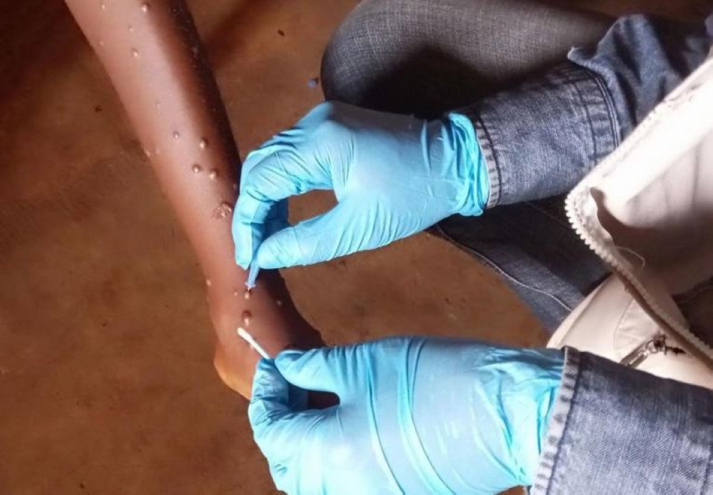 %d8%ac%d8%af%d8%b1%d9%8a %d8%a7%d9%84%d9%82%d8%b1%d8%af%d8%a9 %d9%8a%d8%b6%d8%b1%d8%a8 %d8%a7%d9%84%d9%83%d9%88%d9%86%d8%ba%d9%88 %d8%aa%d8%b3%d8%ac%d9%8a%d9%84 %d9%82%d8%b1%d8%a7%d8%a8%d8%a9 8000