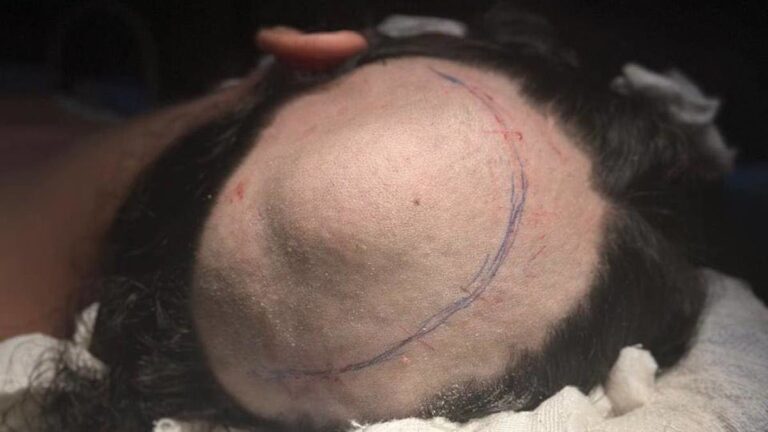 %d8%a8%d8%aa%d9%82%d9%86%d9%8a%d8%a9 3d %d8%a7%d9%84%d9%85%d8%a8%d8%aa%d9%83%d8%b1%d8%a9 %d8%b5%d9%88%d8%b1 %d8%ac%d8%b1%d8%a7%d8%ad%d8%a9 %d8%ae%d8%b7%d9%8a%d8%b1%d8%a9 %d9%84%d8%a5%d8%b2%d8%a7