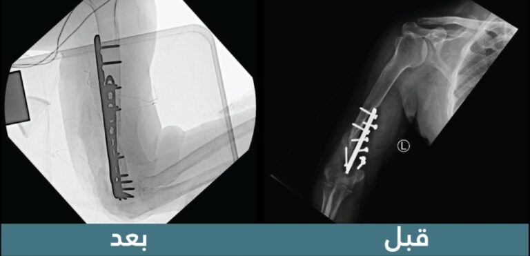 %d8%b3%d8%b9%d9%88%d8%af %d8%a7%d9%84%d8%b7%d8%a8%d9%8a%d8%a9 %d8%aa%d9%86%d9%87%d9%8a %d9%85%d8%b9%d8%a7%d9%86%d8%a7%d8%a9 %d8%a7%d8%b3%d8%aa%d9%85%d8%b1%d8%aa 19 %d8%b9%d8%a7%d9%85%d9%8b%d8%a7