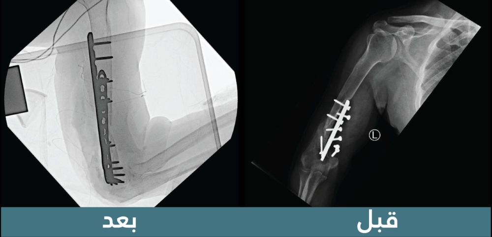 %d8%b3%d8%b9%d9%88%d8%af %d8%a7%d9%84%d8%b7%d8%a8%d9%8a%d8%a9 %d8%aa%d9%86%d9%87%d9%8a %d9%85%d8%b9%d8%a7%d9%86%d8%a7%d8%a9 %d8%a7%d8%b3%d8%aa%d9%85%d8%b1%d8%aa 19 %d8%b9%d8%a7%d9%85%d9%8b%d8%a7