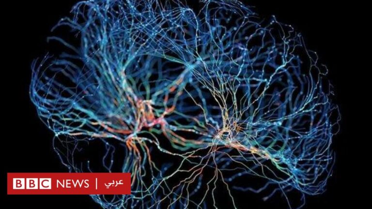 %d9%87%d9%84 %d9%8a%d9%85%d9%83%d9%86 %d8%a3%d9%86 %d8%aa%d8%b9%d8%a7%d9%84%d8%ac %d8%a7%d9%84%d8%ba%d8%b1%d8%b3%d8%a7%d8%aa %d8%a7%d9%84%d8%ac%d8%af%d9%8a%d8%af%d8%a9 %d8%a7%d9%84%d8%a7%d9%83%d8%aa