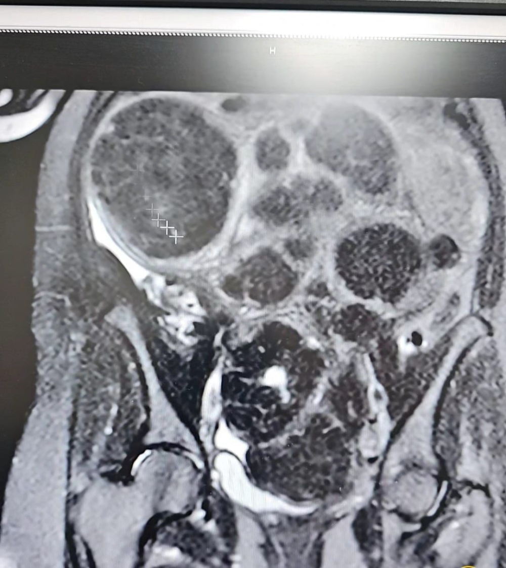 %d9%85%d8%b3%d8%aa%d8%b4%d9%81%d9%89 %d8%a7%d9%84%d8%a5%d9%8a%d9%85%d8%a7%d9%86 %d9%8a%d9%86%d8%ac%d8%ad %d9%81%d9%8a %d8%a7%d8%b3%d8%aa%d8%a6%d8%b5%d8%a7%d9%84 30 %d9%88%d8%b1%d9%85%d9%8b%d8%a7