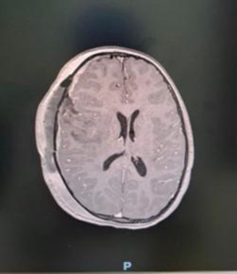 %d8%a7%d9%86%d9%82%d8%a7%d8%b0 %d8%ad%d9%8a%d8%a7%d8%a9 %d8%b7%d9%81%d9%84%d8%a9 %d9%81%d9%8a %d8%b9%d9%82%d8%af%d9%87%d8%a7 %d8%a7%d9%84%d8%a3%d9%88%d9%84 %d9%85%d9%86 %d9%88%d8%b1%d9%85 %d8%b6%d8%ae