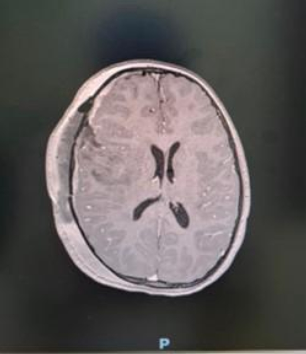 %d8%a7%d9%86%d9%82%d8%a7%d8%b0 %d8%ad%d9%8a%d8%a7%d8%a9 %d8%b7%d9%81%d9%84%d8%a9 %d9%81%d9%8a %d8%b9%d9%82%d8%af%d9%87%d8%a7 %d8%a7%d9%84%d8%a3%d9%88%d9%84 %d9%85%d9%86 %d9%88%d8%b1%d9%85 %d8%b6%d8%ae