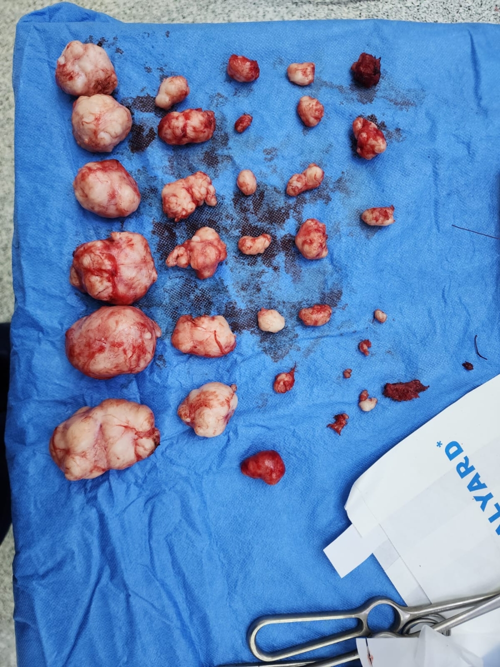 %d8%a7%d8%b3%d8%aa%d8%a6%d8%b5%d8%a7%d9%84 30 %d9%88%d8%b1%d9%85%d9%8b%d8%a7 %d9%84%d9%8a%d9%81%d9%8a%d9%8b%d8%a7 %d9%85%d9%86 %d8%b1%d8%ad%d9%85 %d8%b3%d9%8a%d8%af%d8%a9 %d8%a8%d9%85%d8%b3%d8%aa