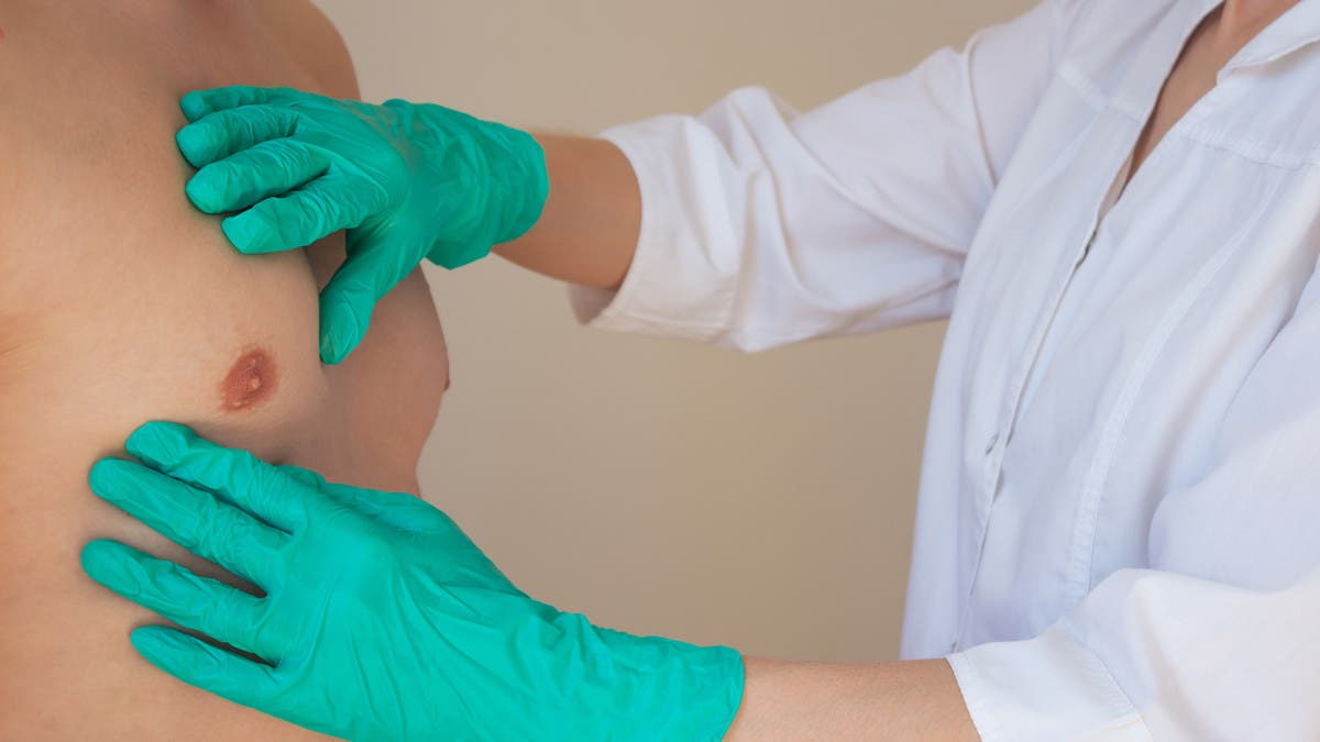 %d8%a7%d9%84%d8%b5%d8%ad%d8%a9 %d8%a7%d9%84%d8%b9%d8%a7%d9%84%d9%85%d9%8a%d8%a9 %d8%b3%d8%b1%d8%b7%d8%a7%d9%86 %d8%a7%d9%84%d8%ab%d8%af%d9%8a %d9%8a%d9%85%d9%83%d9%86 %d8%a3%d9%86 %d9%8a%d8%b5%d9%8a