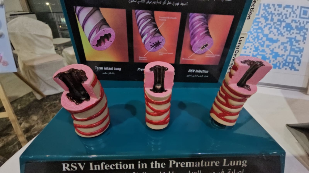 %d8%b5%d9%88%d8%b1 %d9%88%d9%81%d9%8a%d8%af%d9%8a%d9%88 %d9%85%d8%ae%d8%aa%d8%b5 %d9%8a%d9%83%d8%b4%d9%81 %d8%b9%d9%86 %d8%a3%d8%ad%d8%af%d8%ab %d8%b7%d8%b1%d9%82 %d8%b9%d9%84%d8%a7%d8%ac %d8%a3