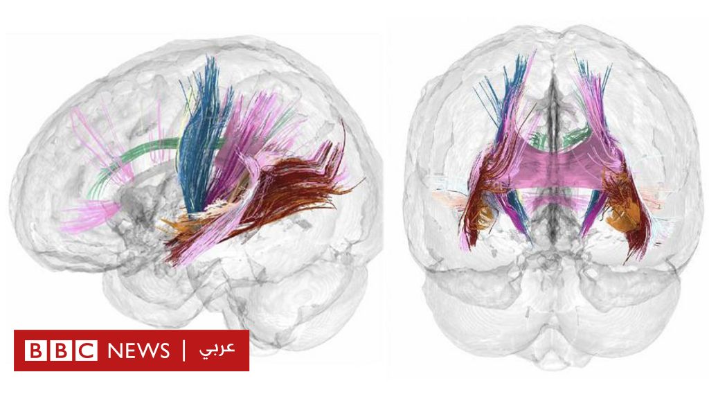 %d8%a3%d8%b4%d8%b9%d8%a9 %d8%aa%d9%81%d8%b5%d9%8a%d9%84%d9%8a%d8%a9 %d8%aa%d9%83%d8%b4%d9%81 %d9%83%d9%8a%d9%81 %d9%8a%d8%aa%d8%ba%d9%8a%d8%b1 %d8%af%d9%85%d8%a7%d8%ba %d8%a7%d9%84%d9%85%d8%b1%d8%a3