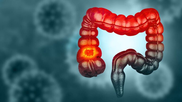 %d8%aa%d8%ac%d8%b1%d8%a8%d8%a9 %d9%85%d8%ab%d9%8a%d8%b1%d8%a9 %d8%ad%d9%88%d9%84 %d8%a5%d9%85%d9%83%d8%a7%d9%86%d9%8a%d8%a9 %d9%85%d9%86%d8%b9 %d8%a7%d9%84%d8%b9%d9%86%d8%a8 %d8%a7%d9%84%d8%a3%d8%ad