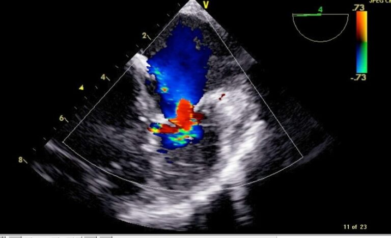 %d9%82%d8%b3%d8%b7%d8%b1%d8%a9 %d9%82%d9%84%d8%a8%d9%8a%d8%a9 %d9%86%d8%a7%d8%af%d8%b1%d8%a9 %d8%aa%d9%86%d9%82%d8%b0 %d8%b7%d9%81%d9%84%d9%8b%d8%a7 %d8%a8%d9%85%d8%b1%d9%83%d8%b2 %d8%a7%d9%84%d8%a3