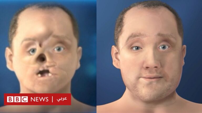 %d8%b9%d9%85%d9%84%d9%8a%d8%a9 %d8%b1%d8%a7%d8%a6%d8%af%d8%a9 %d9%84%d8%b2%d8%b1%d8%a7%d8%b9%d8%a9 %d9%88%d8%ac%d9%87 %d9%85%d8%b9 %d8%a7%d9%84%d8%b9%d9%8a%d9%86 %d9%88%d8%a7%d9%84%d8%a3%d9%86%d9%81