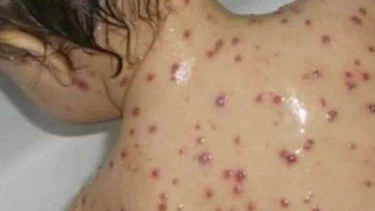 %d8%a8%d8%ad%d9%85%d8%b1%d9%88%d9%86 %d9%8a%d8%ae%d8%b7%d9%81 %d8%a3%d8%b1%d9%88%d8%a7%d8%ad %d8%a7%d9%84%d8%a3%d8%b7%d9%81%d8%a7%d9%84 %d9%81%d9%8a %d8%a7%d9%84%d9%85%d8%ba%d8%b1%d8%a8