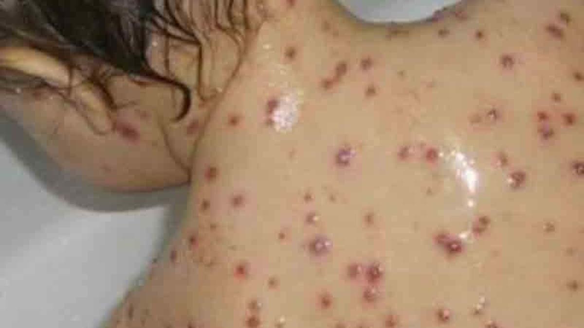 %d8%a8%d8%ad%d9%85%d8%b1%d9%88%d9%86 %d9%8a%d8%ae%d8%b7%d9%81 %d8%a3%d8%b1%d9%88%d8%a7%d8%ad %d8%a7%d9%84%d8%a3%d8%b7%d9%81%d8%a7%d9%84 %d9%81%d9%8a %d8%a7%d9%84%d9%85%d8%ba%d8%b1%d8%a8