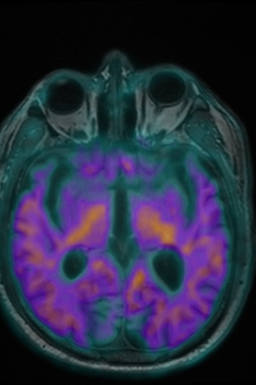 %d8%aa%d8%af%d8%b4%d9%8a%d9%86 %d8%aa%d9%82%d9%86%d9%8a%d8%a9 %d8%ac%d8%af%d9%8a%d8%af%d8%a9 %d9%84%d8%aa%d8%b4%d8%ae%d9%8a%d8%b5 %d8%a7%d9%84%d8%b2%d9%87%d8%a7%d9%8a%d9%85%d8%b1 %d9%84%d8%a3%d9%88