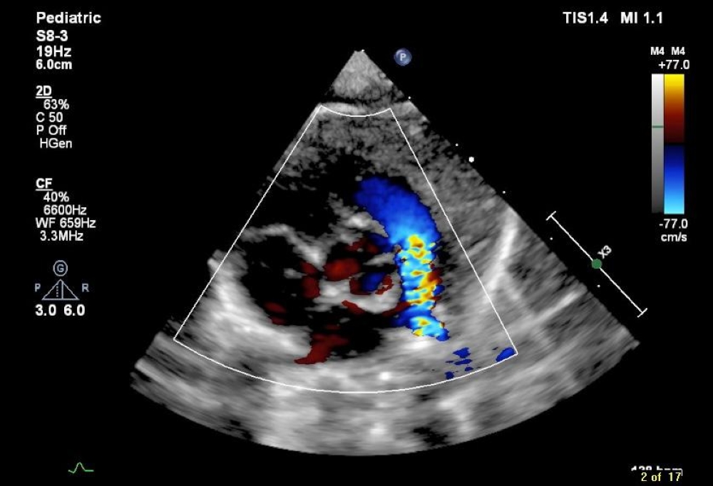 %d9%81%d9%8a %d9%88%d9%82%d8%aa %d9%82%d9%8a%d8%a7%d8%b3%d9%8a %d9%82%d8%b3%d8%b7%d8%b1%d8%a9 %d8%aa%d9%86%d9%82%d8%b0 %d8%b1%d8%b6%d9%8a%d8%b9%d9%8b%d8%a7 %d9%85%d9%86 %d8%b6%d9%8a%d9%82 %d8%a7