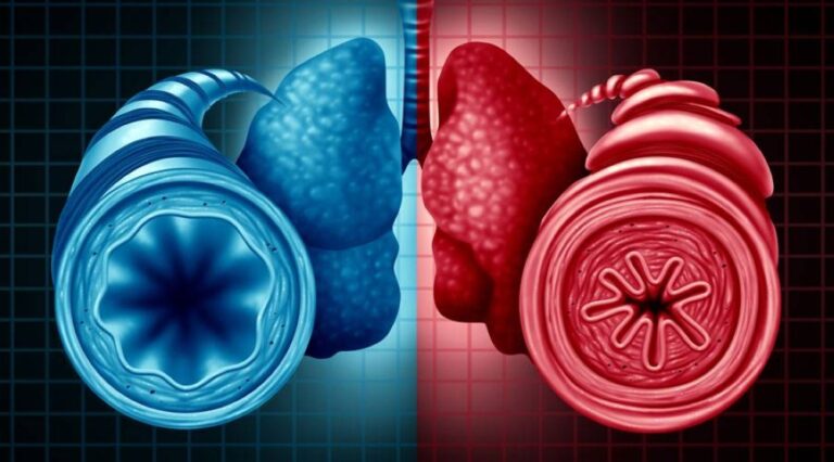 %d8%b9%d9%84%d8%a7%d8%ac %d9%88%d8%a7%d8%b9%d8%af %d9%84%d9%86%d9%88%d8%a8%d8%a7%d8%aa %d8%a7%d9%84%d8%b1%d8%a8%d9%88