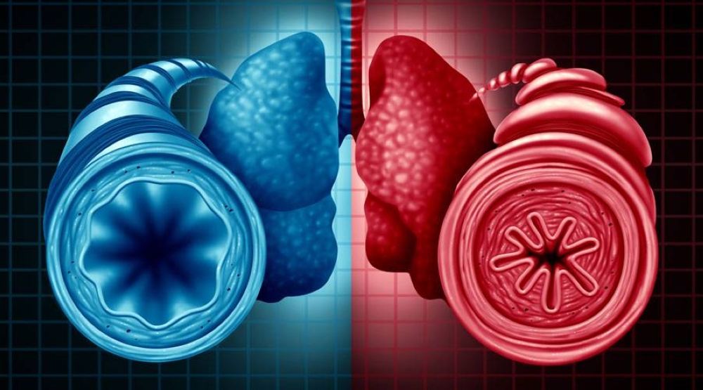 %d8%b9%d9%84%d8%a7%d8%ac %d9%88%d8%a7%d8%b9%d8%af %d9%84%d9%86%d9%88%d8%a8%d8%a7%d8%aa %d8%a7%d9%84%d8%b1%d8%a8%d9%88