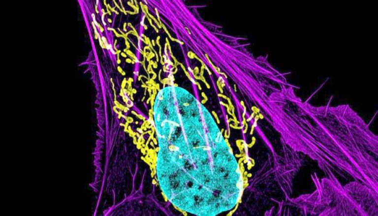 %d8%aa%d9%82%d9%86%d9%8a%d8%a9 %d9%86%d8%a7%d9%86%d9%88%d9%8a%d8%a9 %d8%aa%d8%af%d9%85%d8%b1 %d8%a7%d9%84%d8%ae%d9%84%d8%a7%d9%8a%d8%a7 %d8%a7%d9%84%d8%b3%d8%b1%d8%b7%d8%a7%d9%86%d9%8a%d8%a9