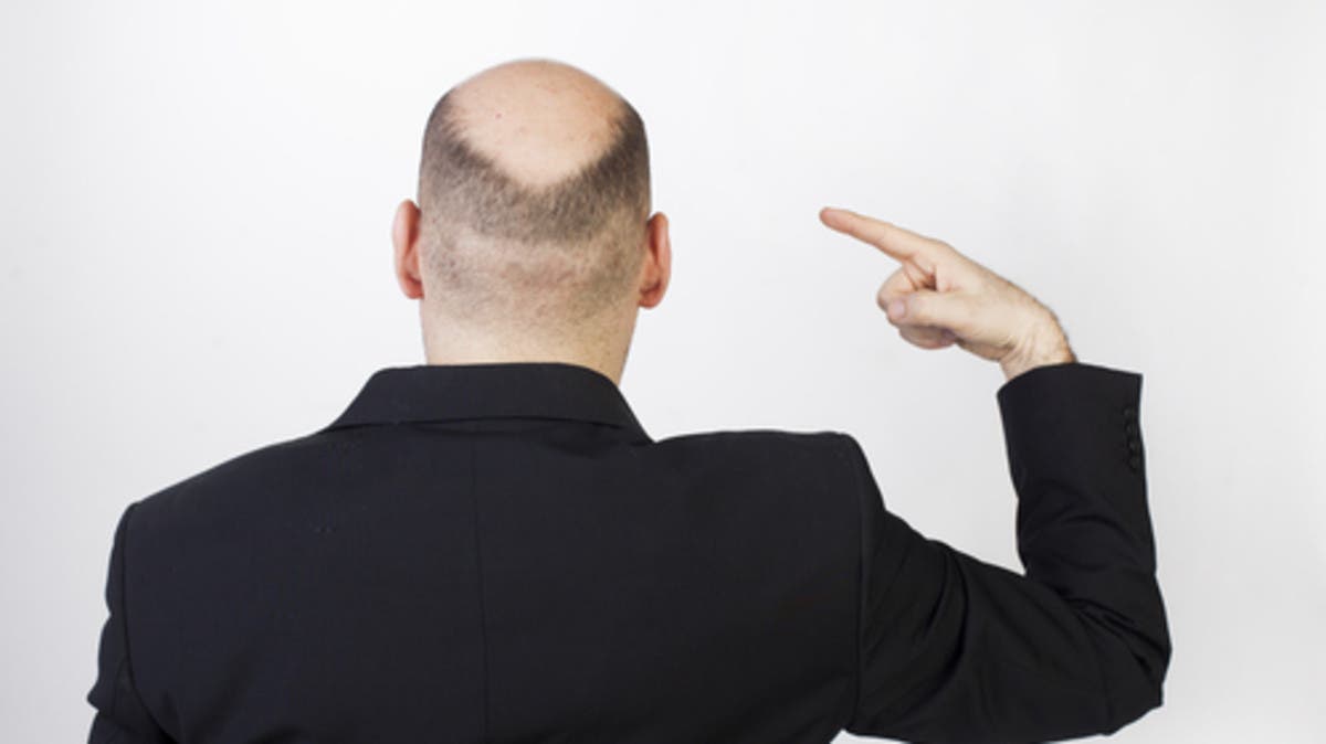 %d9%85%d9%81%d8%a7%d8%ac%d8%a3%d8%a9 %d8%b9%d9%84%d8%a7%d8%ac %d8%ac%d8%af%d9%8a%d8%af %d9%85%d8%ad%d8%aa%d9%85%d9%84 %d9%84%d9%84%d8%b5%d9%84%d8%b9 %d8%a7%d9%84%d9%88%d8%b1%d8%a7%d8%ab%d9%8a