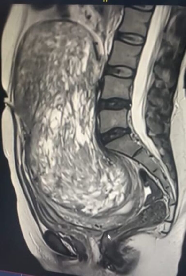 %d8%a7%d8%b3%d8%aa%d8%a6%d8%b5%d8%a7%d9%84 %d9%88%d8%b1%d9%85 %d8%a8%d8%ad%d8%ac%d9%85 %d8%ac%d9%86%d9%8a%d9%86 %d9%85%d9%86 %d8%ab%d9%84%d8%a7%d8%ab%d9%8a%d9%86%d9%8a%d8%a9 %d8%a8%d9%85%d8%af%d9%8a