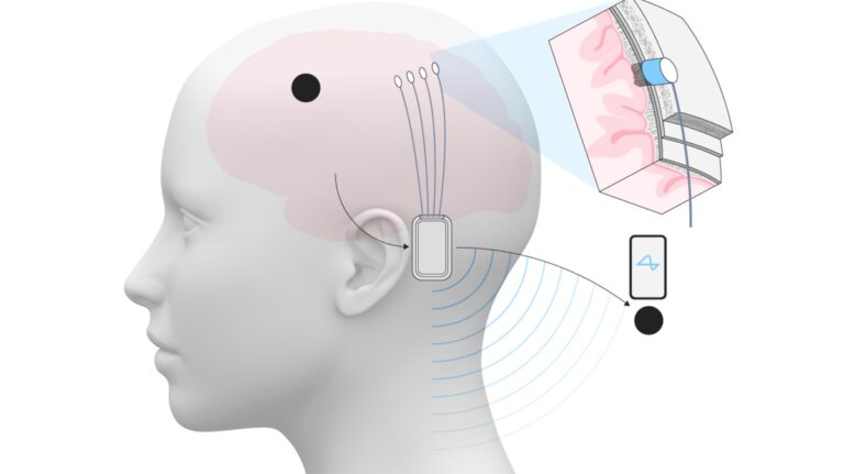 %d9%85%d8%a7%d8%b3%d9%83 %d9%8a%d8%b9%d9%84%d9%86 %d9%86%d8%ac%d8%a7%d8%ad %d8%b2%d8%b1%d8%b9 %d8%b4%d8%b1%d9%8a%d8%ad%d8%a9 %d8%af%d9%85%d8%a7%d8%ba%d9%8a%d8%a9 %d9%84%d8%b4%d8%ae%d8%b5 %d8%ab%d8%a7