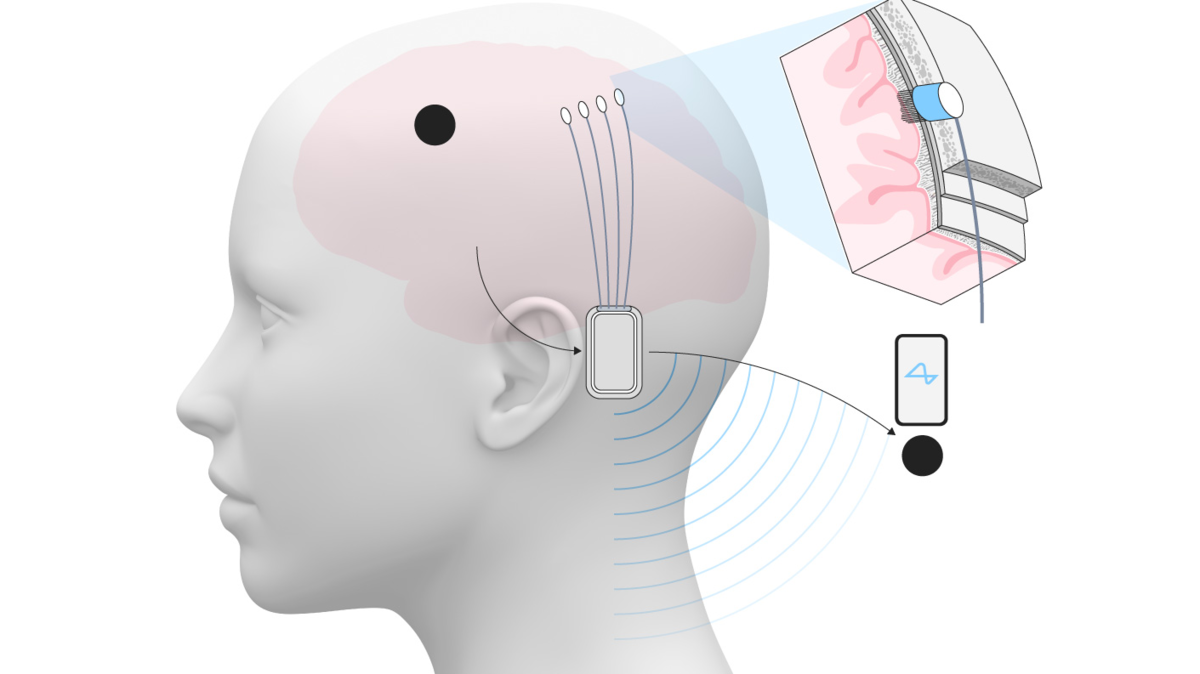 %d9%85%d8%a7%d8%b3%d9%83 %d9%8a%d8%b9%d9%84%d9%86 %d9%86%d8%ac%d8%a7%d8%ad %d8%b2%d8%b1%d8%b9 %d8%b4%d8%b1%d9%8a%d8%ad%d8%a9 %d8%af%d9%85%d8%a7%d8%ba%d9%8a%d8%a9 %d9%84%d8%b4%d8%ae%d8%b5 %d8%ab%d8%a7