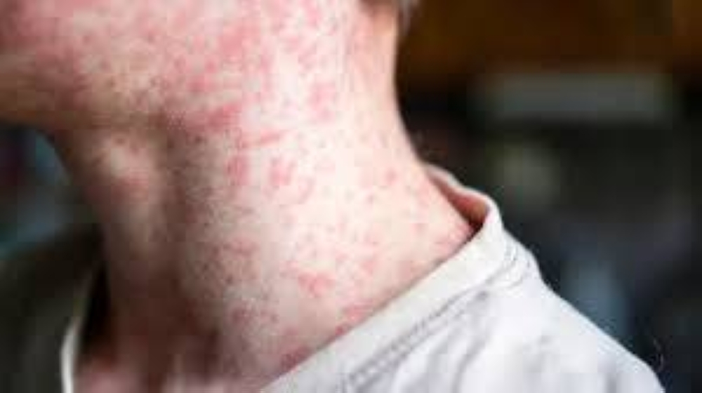 %d8%a7%d9%84%d9%85%d8%ba%d8%b1%d8%a8 %d9%87%d9%84 %d8%aa%d8%ad%d9%88%d9%84 %d8%a8%d9%88%d8%ad%d9%85%d8%b1%d9%88%d9%86 %d8%a5%d9%84%d9%89 %d9%88%d8%a8%d8%a7%d8%a1%d8%9f