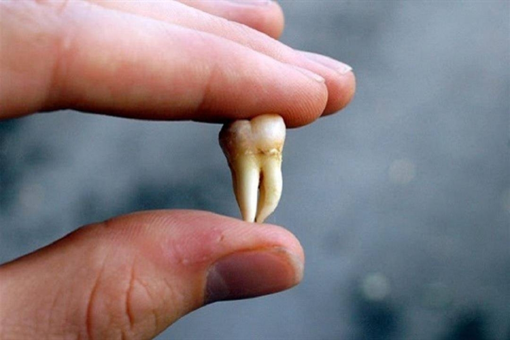 %d9%85%d8%a7 %d8%a7%d9%84%d8%ad%d8%a7%d9%84%d8%a7%d8%aa %d8%a7%d9%84%d8%aa%d9%8a %d9%8a%d8%ac%d8%a8 %d9%81%d9%8a%d9%87%d8%a7 %d9%82%d9%84%d8%b9 %d8%a3%d8%b6%d8%b1%d8%a7%d8%b3 %d8%a7%d9%84%d8%b9%d9%82