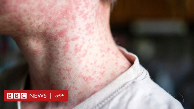 %d8%a8%d9%88%d8%ad%d9%85%d8%b1%d9%88%d9%86 %d8%a7%d9%86%d8%aa%d8%b4%d8%a7%d8%b1 %d8%ba%d9%8a%d8%b1 %d9%85%d8%b3%d8%a8%d9%88%d9%82 %d9%84%d9%84%d8%ad%d8%b5%d8%a8%d8%a9 %d9%81%d9%8a %d8%a7%d9%84