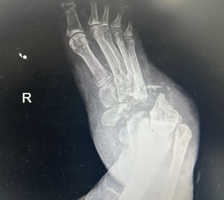 %d8%a5%d9%86%d9%82%d8%a7%d8%b0 %d9%82%d8%af%d9%85 %d9%85%d8%b1%d9%8a%d8%b6%d8%a9 %d9%85%d9%86 %d8%a7%d9%84%d8%a8%d8%aa%d8%b1 %d8%a8%d8%b9%d8%af %d9%85%d8%b9%d8%a7%d9%86%d8%a7%d8%a9 %d8%af%d8%a7%d9%85