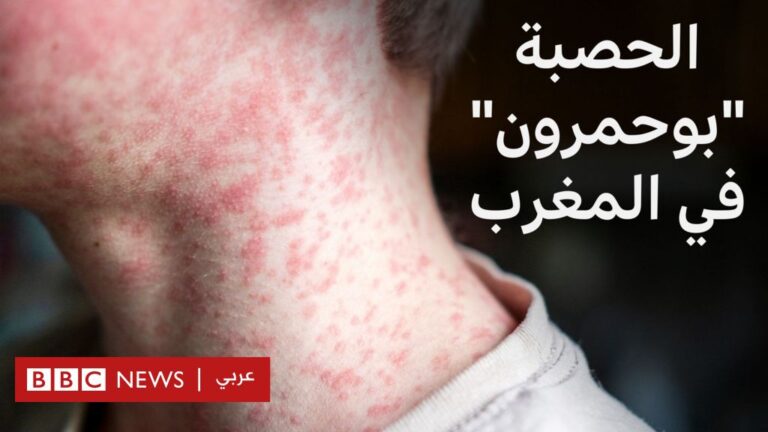 %d9%85%d8%a7%d8%b0%d8%a7 %d9%86%d8%b9%d8%b1%d9%81 %d8%b9%d9%86 %d8%a7%d9%84%d8%ad%d8%b5%d8%a8%d8%a9 %d8%a3%d9%88 %d8%a8%d9%88%d8%ad%d9%85%d8%b1%d9%88%d9%86 %d8%a7%d9%84%d8%b0%d9%8a %d9%8a%d9%86