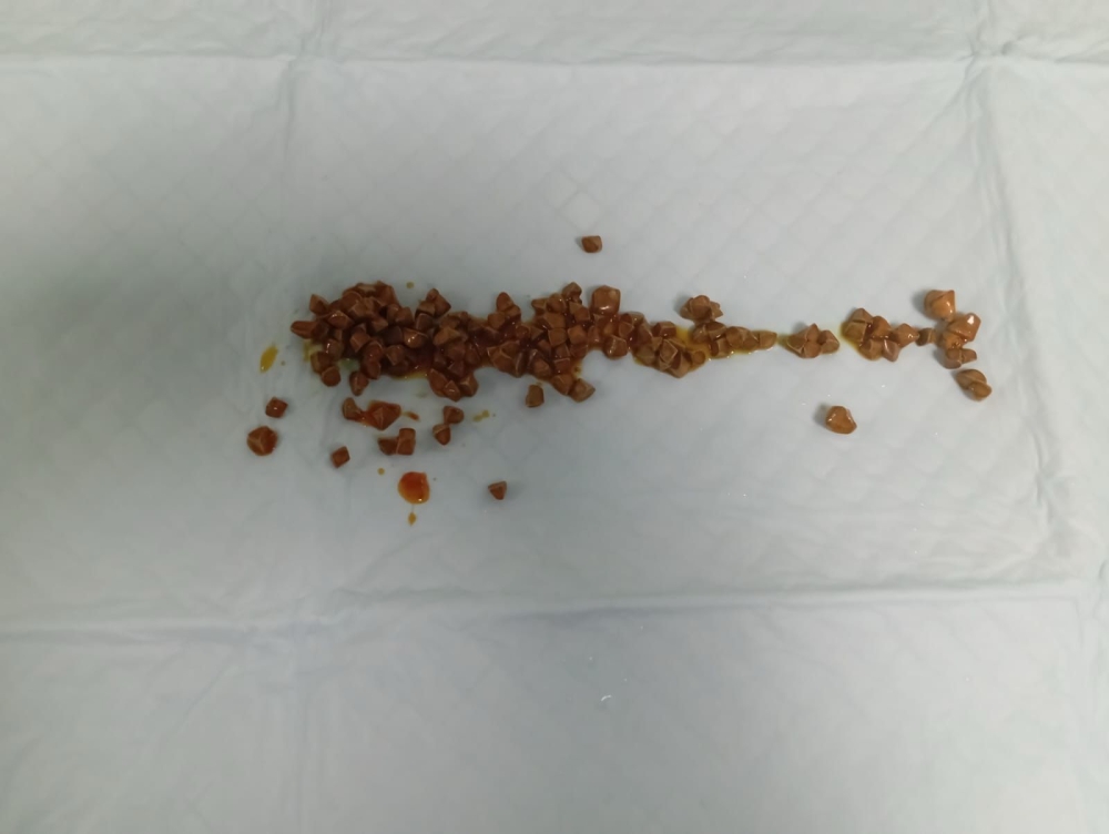 %d8%a5%d9%86%d9%82%d8%a7%d8%b0 %d9%85%d8%b1%d9%8a%d8%b6 %d8%ab%d9%84%d8%a7%d8%ab%d9%8a%d9%86%d9%8a %d8%a8%d8%a7%d8%b3%d8%aa%d8%ae%d8%b1%d8%a7%d8%ac 140 %d8%ad%d8%b5%d9%88%d8%a9 %d9%85%d9%86 %d8%a7