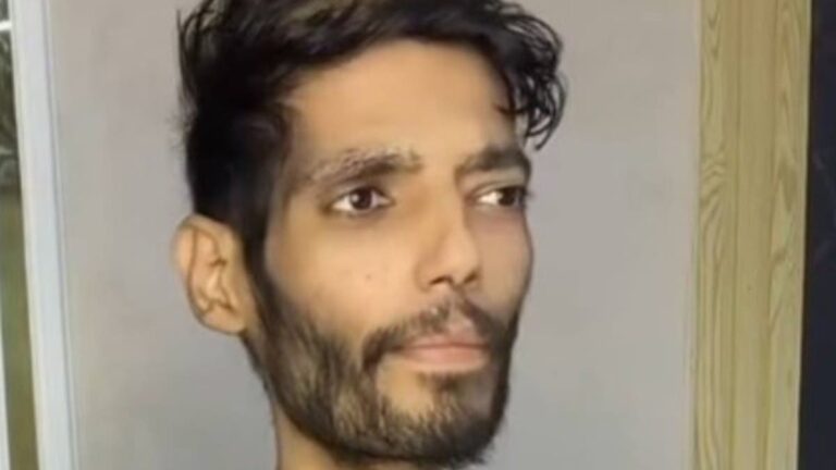 %d9%84%d8%a7%d8%b9%d8%a8 %d9%85%d8%b5%d8%b1%d9%8a %d9%85%d8%b1%d9%8a%d8%b6 %d8%a8%d8%a7%d9%84%d8%b3%d8%b1%d8%b7%d8%a7%d9%86 %d9%8a%d8%b4%d8%aa%d9%83%d9%8a %d8%aa%d8%ac%d8%a7%d9%87%d9%84%d9%87 %d9%88