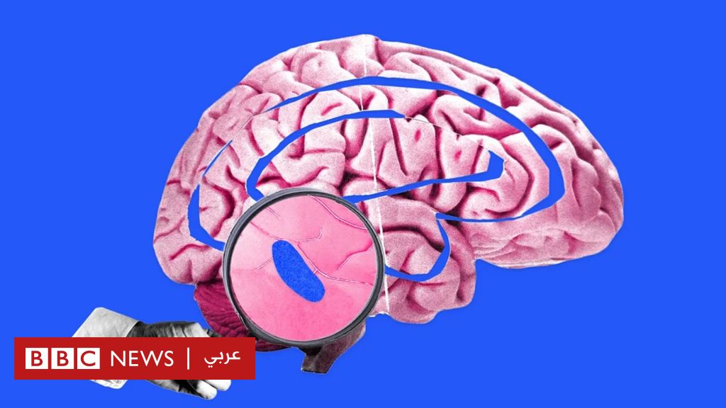 %d8%a7%d9%84%d9%86%d9%88%d9%85 %d9%83%d9%8a%d9%81 %d8%aa%d8%b9%d9%85%d9%84 %d8%a7%d9%84%d9%86%d9%82%d8%b7%d8%a9 %d8%a7%d9%84%d8%b2%d8%b1%d9%82%d8%a7%d8%a1 %d8%a7%d9%84%d8%b5%d8%ba%d9%8a%d8%b1%d8%a9