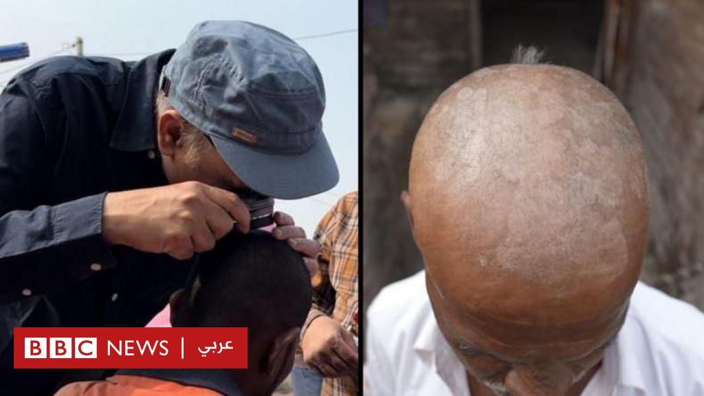 %d8%b8%d8%a7%d9%87%d8%b1%d8%a9 %d8%ba%d8%a7%d9%85%d8%b6%d8%a9 %d8%aa%d8%aa%d8%b3%d8%a8%d8%a8 %d9%81%d9%8a %d8%b3%d9%82%d9%88%d8%b7 %d8%b4%d8%b9%d8%b1 %d8%ac%d9%85%d8%a7%d8%b9%d9%8a %d9%84%d8%b3%d9%83