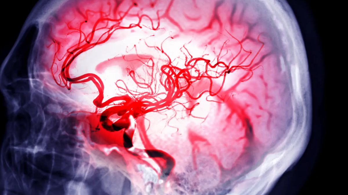 %d8%a7%d9%86%d9%81%d8%ac%d8%a7%d8%b1 %d8%ba%d8%a7%d9%85%d8%b6 %d8%a8%d8%a7%d9%84%d9%85%d8%ae %d9%85%d8%a7%d8%b0%d8%a7 %d9%8a%d8%ad%d8%af%d8%ab %d8%a8%d8%a3%d8%af%d9%85%d8%ba%d8%a9 %d8%a7%d9%84