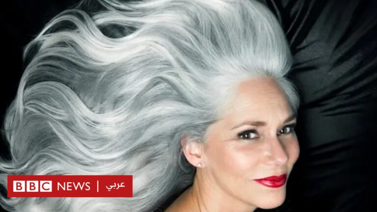 %d8%b4%d9%8a%d8%a8 %d8%a7%d9%84%d8%b4%d8%b9%d8%b1 %d9%84%d9%85%d8%a7%d8%b0%d8%a7 %d9%8a%d8%b8%d9%87%d8%b1 %d8%a7%d9%84%d8%b4%d8%b9%d8%b1 %d8%a7%d9%84%d8%a3%d8%a8%d9%8a%d8%b6 %d9%81%d9%8a %d8%b1%d8%a3