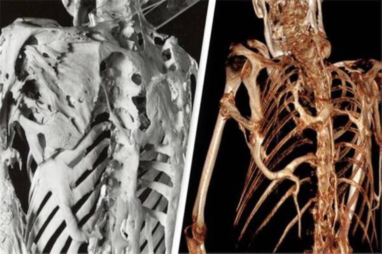 %d9%85%d8%b1%d8%b6 %d9%86%d8%a7%d8%af%d8%b1 %d9%8a%d8%ad%d9%88%d9%84 %d8%a7%d9%84%d8%ac%d8%b3%d9%85 %d8%a5%d9%84%d9%89 %d8%aa%d9%85%d8%ab%d8%a7%d9%84 %d8%ad%d8%ac%d8%b1%d9%8a