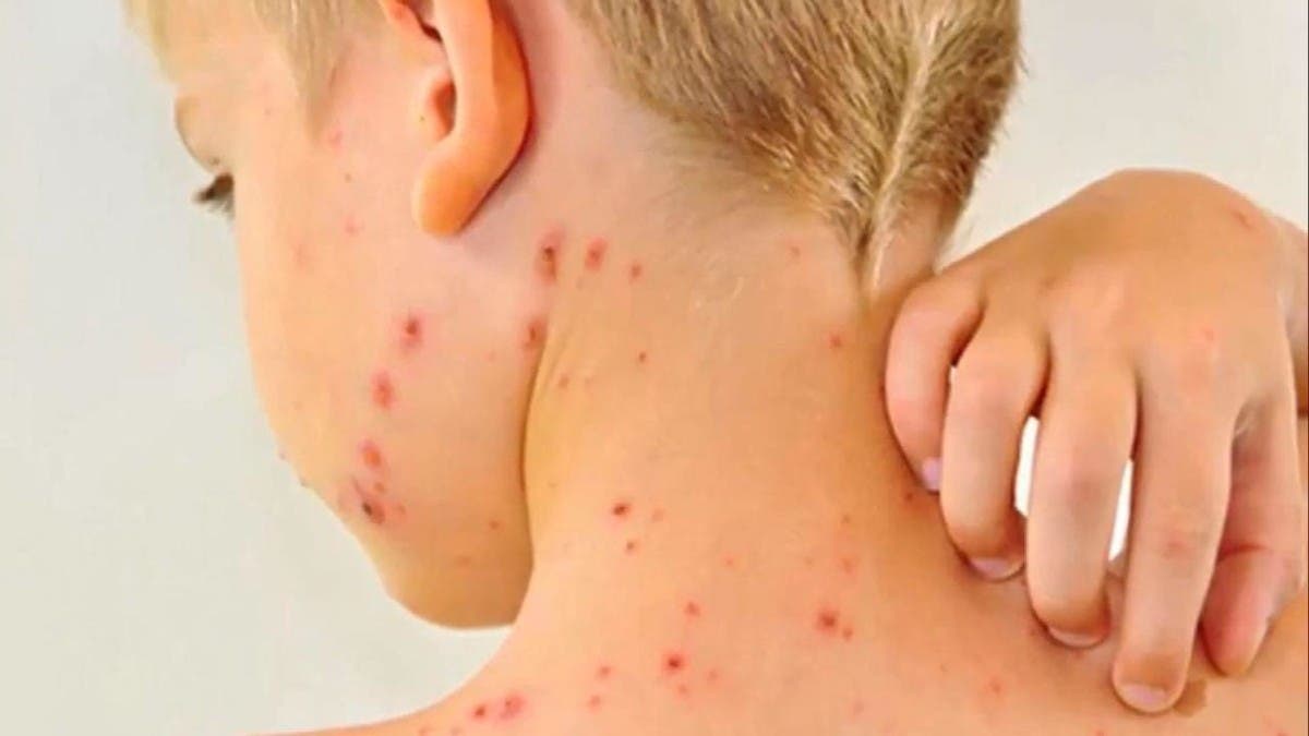 %d8%a3%d9%85%d9%8a%d8%b1%d9%83%d8%a7 %d8%aa%d8%b4%d9%87%d8%af %d8%a3%d9%83%d8%a8%d8%b1 %d9%85%d9%88%d8%ac%d8%a9 %d8%aa%d9%81%d8%b4%d9%8a %d9%84%d9%84%d8%ad%d8%b5%d8%a8%d8%a9 %d8%ae%d9%84%d8%a7%d9%84 1