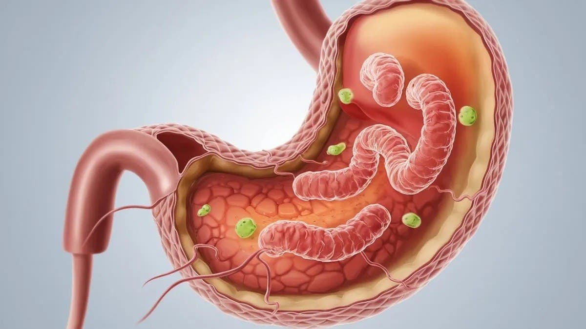 8 %d8%a3%d8%b7%d8%b9%d9%85%d8%a9 %d8%aa%d8%b3%d8%a7%d8%b9%d8%af %d9%81%d9%8a %d8%b9%d9%84%d8%a7%d8%ac %d8%ac%d8%b1%d8%ab%d9%88%d9%85%d8%a9 %d8%a7%d9%84%d9%85%d8%b9%d8%af%d8%a9 %d9%88%d8%a7%d9%84