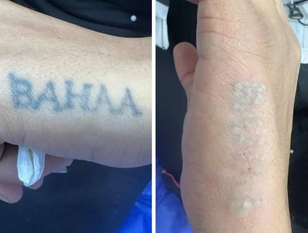 %d8%a5%d9%86%d8%af%d9%88%d9%86%d9%8a%d8%b3%d9%8a%d8%a7 %d8%aa%d8%b2%d9%8a%d9%84 %d8%a3%d9%88%d8%b4%d8%a7%d9%85%d9%87%d8%a7 %d9%81%d9%8a %d8%b1%d9%85%d8%b6%d8%a7%d9%86 %d8%ae%d8%af%d9%85%d8%a9 %d9%85