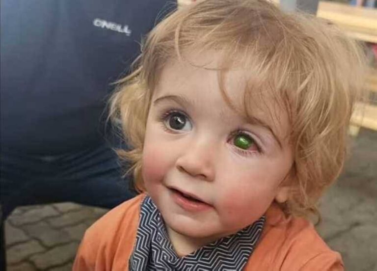 %d8%b7%d9%81%d9%84 %d8%a8%d8%b1%d9%8a%d8%b7%d8%a7%d9%86%d9%8a %d9%8a%d9%81%d9%82%d8%af %d8%b9%d9%8a%d9%86%d9%87 %d8%a8%d8%b3%d8%a8%d8%a8 %d9%82%d8%a8%d9%84%d8%a9 %d8%a7%d8%ad%d8%b0%d8%b1%d9%88%d8%a7