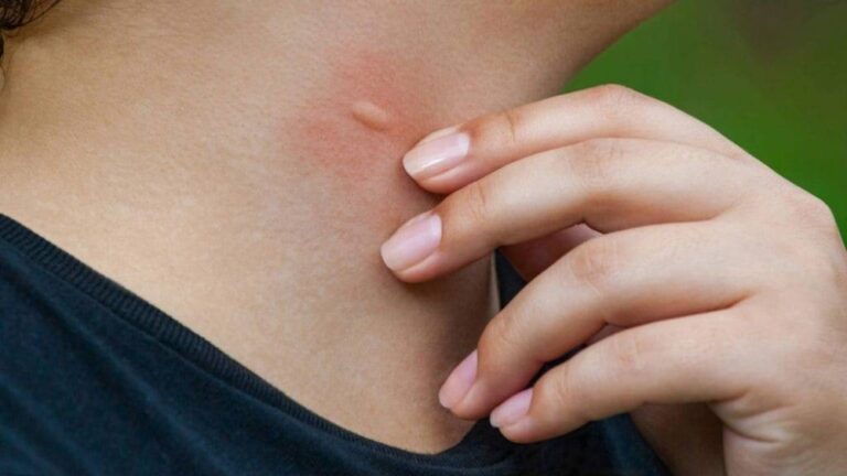 %d8%a8%d8%b9%d8%af %d8%a7%d9%84%d8%aa%d8%ad%d8%b0%d9%8a%d8%b1 %d8%a7%d9%84%d8%b9%d8%a7%d8%ac%d9%84 %d9%84%d9%84%d8%b5%d8%ad%d8%a9 %d8%a7%d9%84%d8%b9%d8%a7%d9%84%d9%85%d9%8a%d8%a9 %d9%87%d9%84 %d8%aa