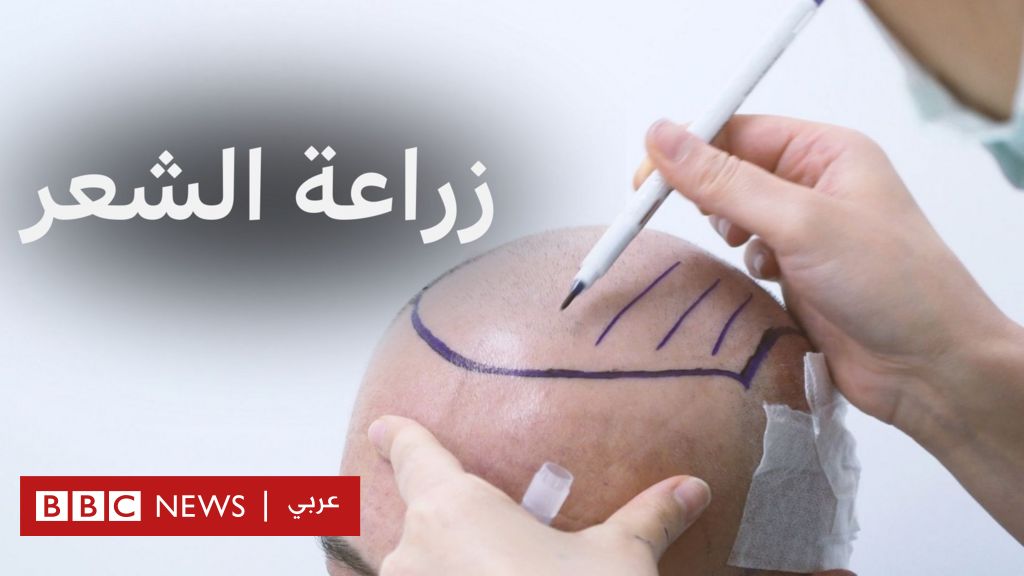 %d9%83%d9%8a%d9%81 %d8%aa%d8%aa%d9%85 %d8%b2%d8%b1%d8%a7%d8%b9%d8%a9 %d8%a7%d9%84%d8%b4%d8%b9%d8%b1 %d9%88%d9%85%d8%a7 %d9%87%d9%8a %d8%a3%d8%b6%d8%b1%d8%a7%d8%b1%d9%87%d8%a7%d8%9f