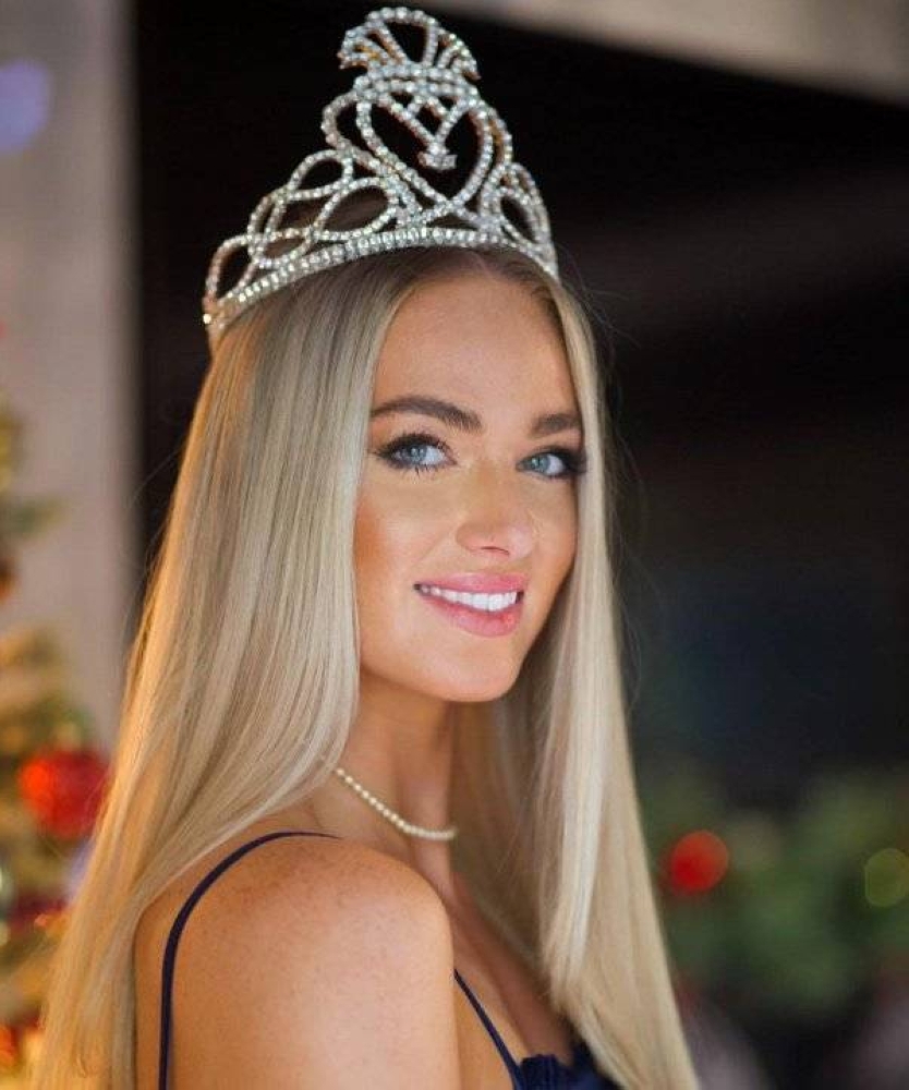 %d8%b9%d8%b6%d9%91%d8%a9 %d8%aa%d8%ac%d8%b1%d8%af %d9%85%d9%84%d9%83%d8%a9 %d8%ac%d9%85%d8%a7%d9%84 %d8%a3%d8%b3%d9%83%d8%aa%d9%84%d9%86%d8%af%d8%a7 %d9%85%d9%86 %d9%84%d9%82%d8%a8%d9%87