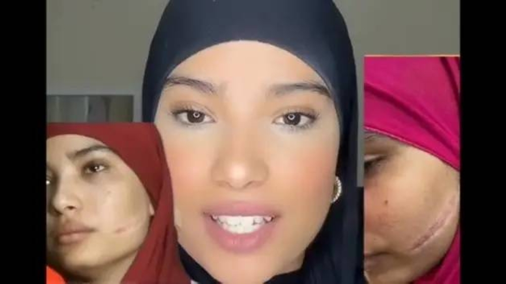 بعد تشويه وجهها.. تهديد جديد يعيد قضية سلمى المغربية إلى الواجهة