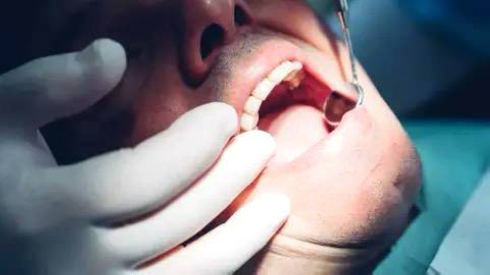 إنماء سن بشري في المختبر.. ثورة في طب الأسنان