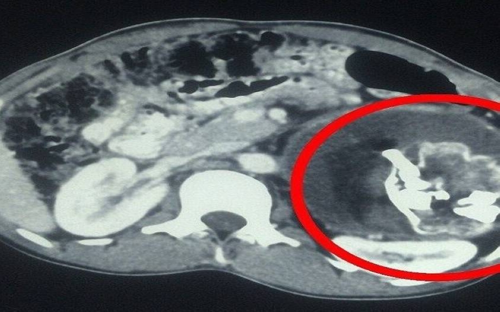 %d9%85%d8%b9%d8%ac%d8%b2%d8%a9 %d8%b7%d8%a8%d9%8a%d8%a9 %d8%a7%d8%b3%d8%aa%d8%ae%d8%b1%d8%a7%d8%ac %d8%ac%d9%86%d9%8a%d9%86 %d8%b7%d9%81%d9%8a%d9%84%d9%8a %d9%85%d9%86 %d8%a8%d8%b7%d9%86