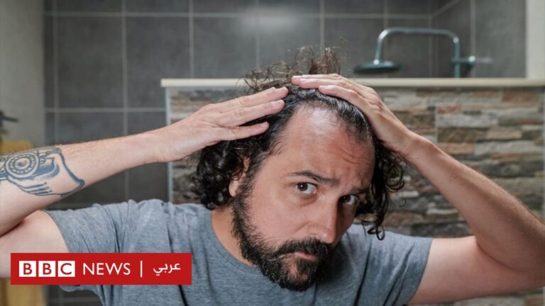 %d9%87%d9%84 %d9%87%d9%86%d8%a7%d9%83 %d8%ad%d9%84%d9%88%d9%84 %d9%84%d9%84%d8%ad%d9%81%d8%a7%d8%b8 %d8%b9%d9%84%d9%89 %d8%a7%d9%84%d8%b4%d8%b9%d8%b1 %d9%85%d9%86 %d8%a7%d9%84%d8%aa%d8%b3%d8%a7%d9%82